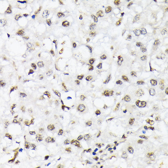 Phospho-FOXO1/FOXO3/FOXO4 (Thr24, Thr32, Thr28) Antibody in Immunohistochemistry (Paraffin) (IHC (P))