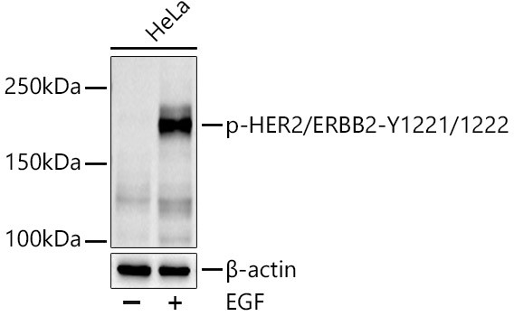 Phospho-ErbB2 (HER-2) (Tyr1221, Tyr1222) Antibody in Western Blot (WB)