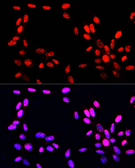 Phospho-Histone H3 (Ser10, Thr11) Antibody in Immunocytochemistry (ICC/IF)