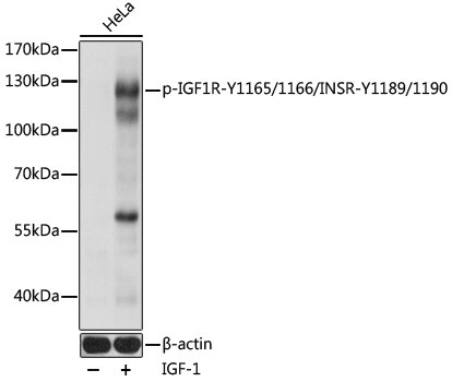 Phospho-IR/IGF1R (Tyr1165, Tyr1166, Tyr1189, Tyr1190) Antibody in Western Blot (WB)