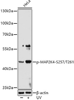 Phospho-MAP2K4 (Ser257, Thr261) Antibody in Western Blot (WB)