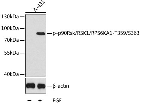 Phospho-RSK1 (Thr359, Ser363) Antibody in Western Blot (WB)