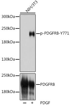 Phospho-PDGFRB (Tyr771) Antibody in Western Blot (WB)
