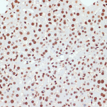 Phospho-POLR2A (Ser5) Antibody in Immunohistochemistry (Paraffin) (IHC (P))