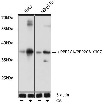 Phospho-PP2A alpha/beta (Tyr307) Antibody in Western Blot (WB)