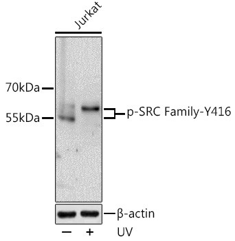 Phospho-LCK/FYN (Tyr416) Antibody in Western Blot (WB)