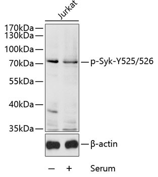 Phospho-Syk (Tyr525, Tyr526) Antibody in Western Blot (WB)