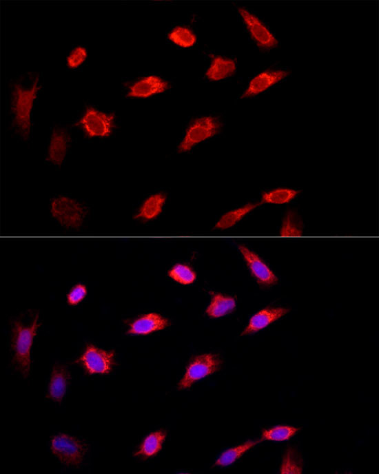 PI4KB Antibody in Immunocytochemistry (ICC/IF)