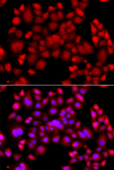 PIP4K2B Antibody in Immunocytochemistry (ICC/IF)