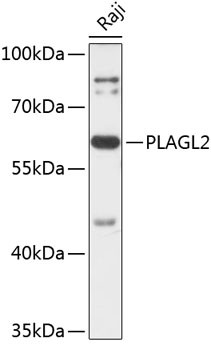PLAGL2 Antibody in Western Blot (WB)