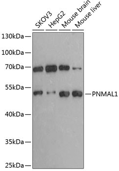PNMAL1 Antibody in Western Blot (WB)