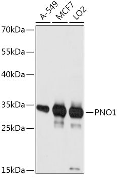 PNO1 Antibody in Western Blot (WB)