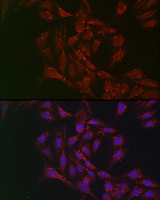 ATGL Antibody in Immunocytochemistry (ICC/IF)