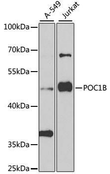 POC1B Antibody in Western Blot (WB)