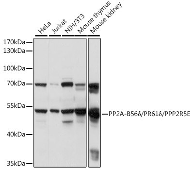 PPP2R5E Antibody in Western Blot (WB)