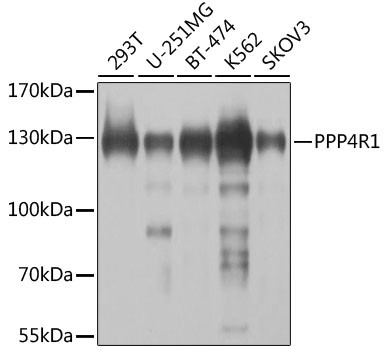 PPP4R1 Antibody in Western Blot (WB)