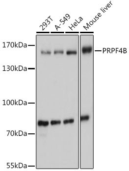 PRPF4B Antibody in Western Blot (WB)