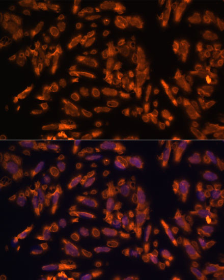 PRX Antibody in Immunocytochemistry (ICC/IF)