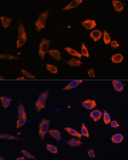 RAB5B Antibody in Immunocytochemistry (ICC/IF)