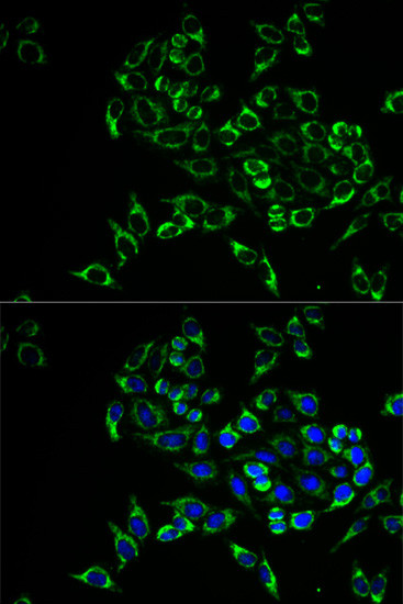 RANKL Antibody in Immunocytochemistry (ICC/IF)