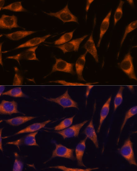 RAPH1 Antibody in Immunocytochemistry (ICC/IF)