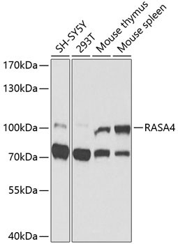 RASA4 Antibody in Western Blot (WB)