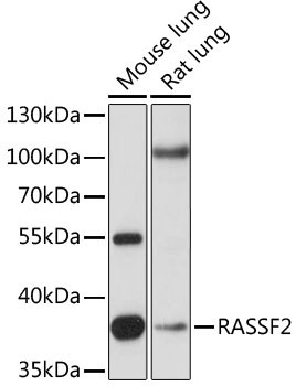 RASSF2 Antibody in Western Blot (WB)