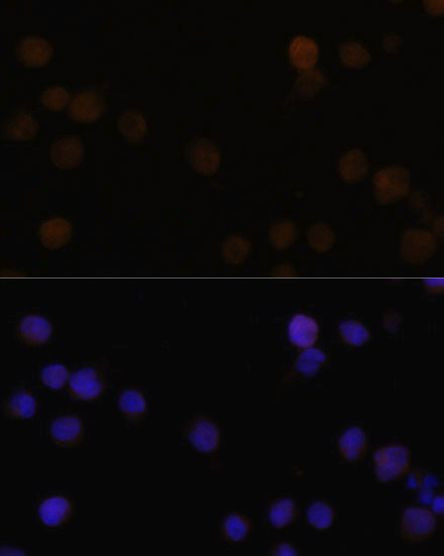 Rb Antibody in Immunocytochemistry (ICC/IF)
