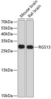 RGS13 Antibody in Western Blot (WB)