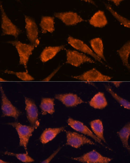 RHBDF1 Antibody in Immunocytochemistry (ICC/IF)