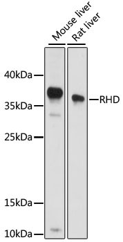 RHD Antibody in Western Blot (WB)