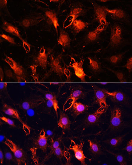 RNF149 Antibody in Immunocytochemistry (ICC/IF)