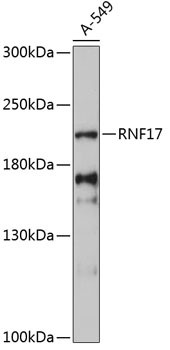 RNF17 Antibody in Western Blot (WB)