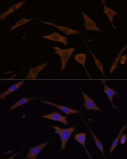 RPL7 Antibody in Immunocytochemistry (ICC/IF)