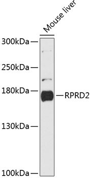 RPRD2 Antibody in Western Blot (WB)