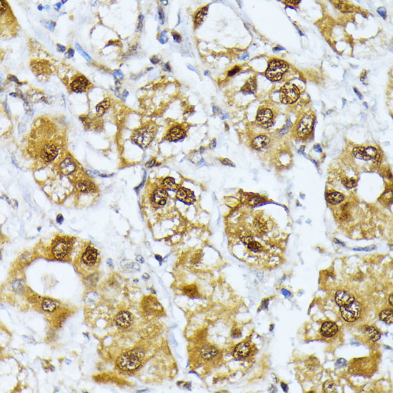 RRAGD Antibody in Immunohistochemistry (Paraffin) (IHC (P))