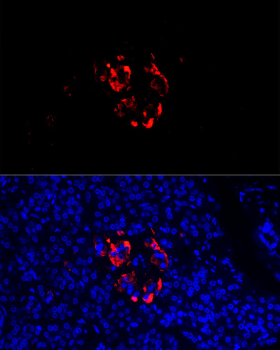 Chromogranin C Antibody in Immunocytochemistry (ICC/IF)