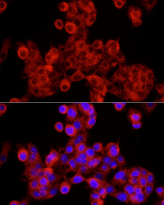 SEC24C Antibody in Immunocytochemistry (ICC/IF)