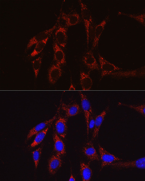 SBP2 Antibody in Immunocytochemistry (ICC/IF)