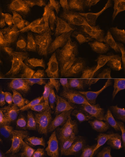 SEPT5 Antibody in Immunocytochemistry (ICC/IF)