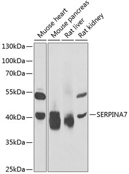 SERPINA7 Antibody in Western Blot (WB)