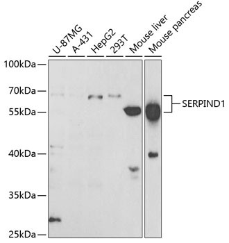 Heparin Cofactor II Antibody in Western Blot (WB)