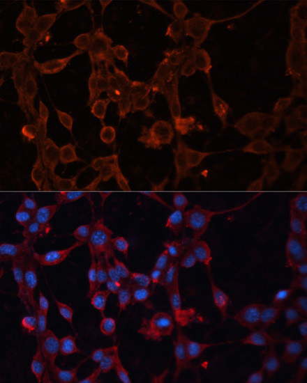 UCP4 Antibody in Immunocytochemistry (ICC/IF)