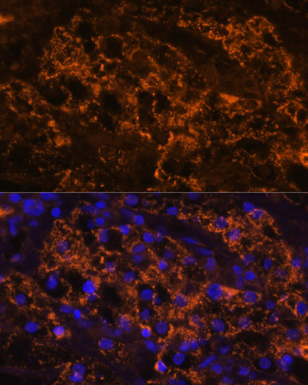 SLC7A9 Antibody in Immunohistochemistry (Paraffin) (IHC (P))