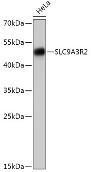 NHERF2 Antibody in Western Blot (WB)