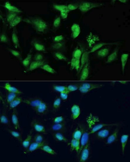 SMAD2/SMAD3 Antibody in Immunocytochemistry (ICC/IF)