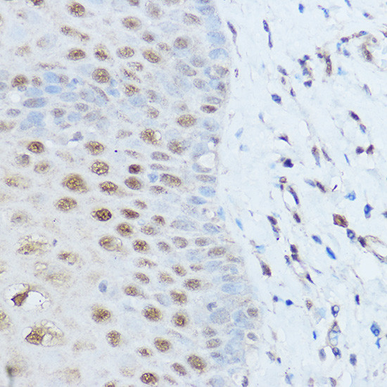 SMARCD2 Antibody in Immunohistochemistry (Paraffin) (IHC (P))