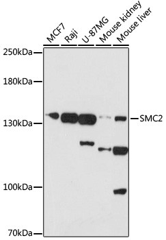 SMC2 Antibody in Western Blot (WB)