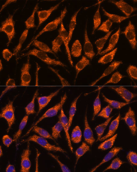 SNX15 Antibody in Immunocytochemistry (ICC/IF)