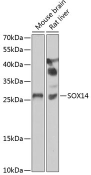 SOX14 Antibody in Western Blot (WB)